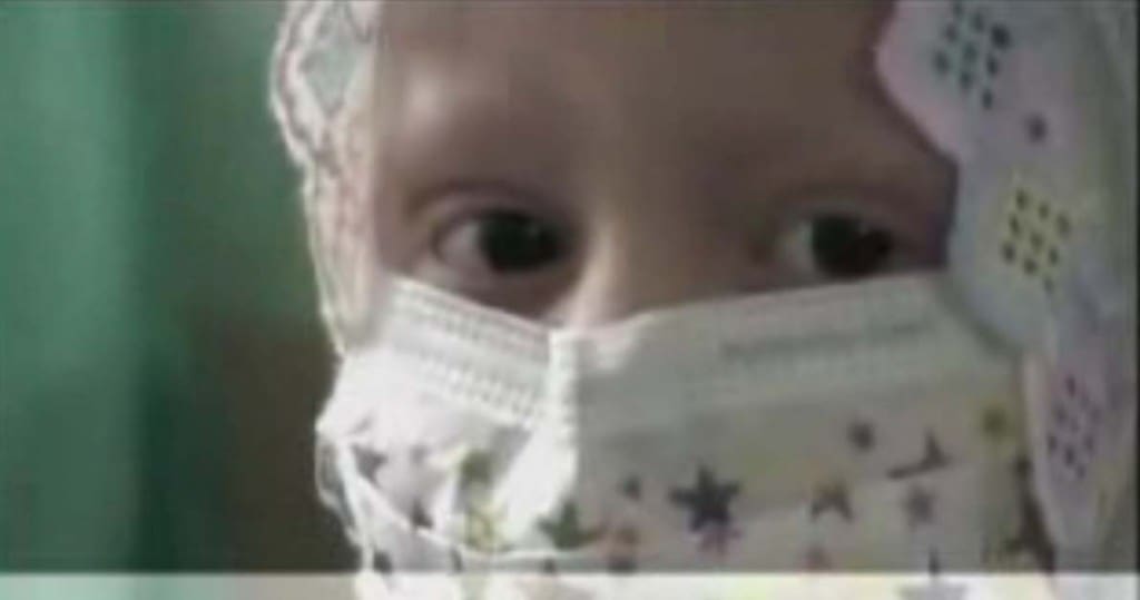child cancer patient - staring eyes